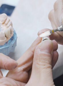 Lab Burs